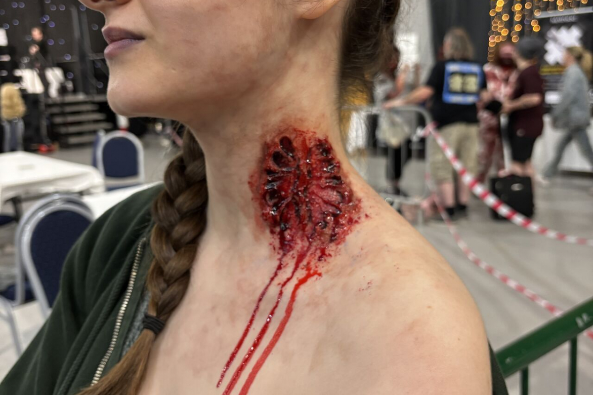 Student with a prosthetic neck wound 